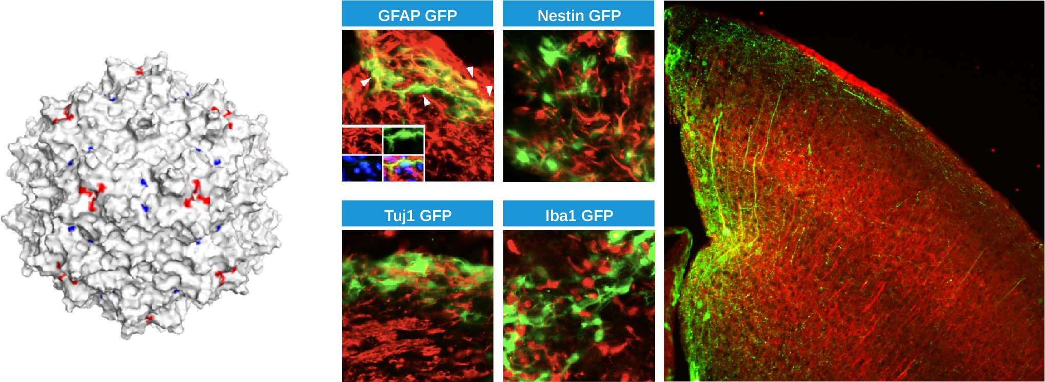 Glugene therapeutics; Pipeline; Astrocyte targeted; AAV